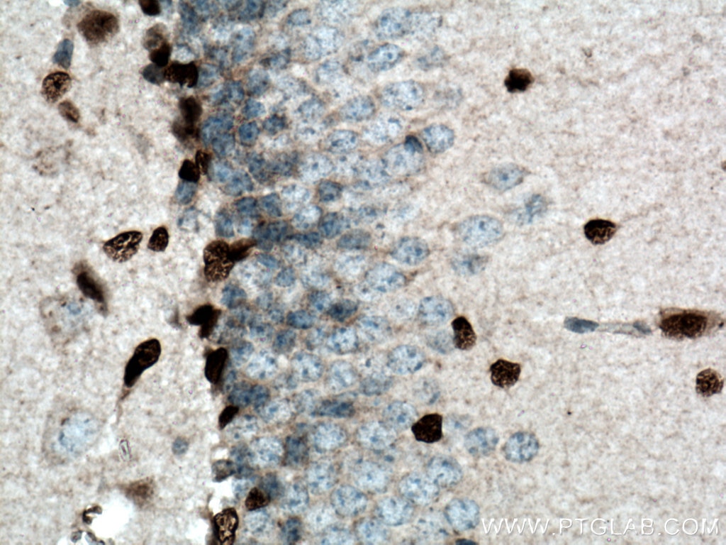 IHC staining of mouse brain using 11064-1-AP