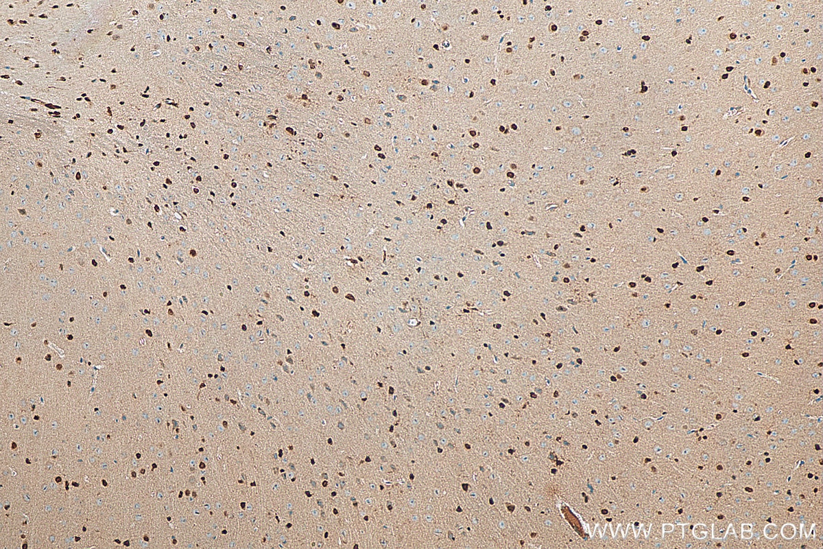 Immunohistochemistry (IHC) staining of mouse brain tissue using SOX2 Polyclonal antibody (11064-1-AP)