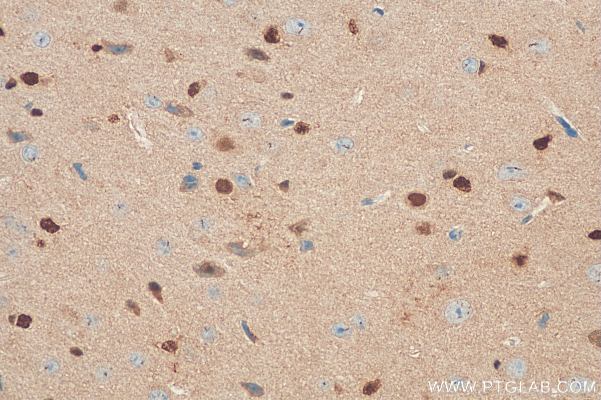 Immunohistochemistry (IHC) staining of mouse brain tissue using SOX2 Polyclonal antibody (11064-1-AP)