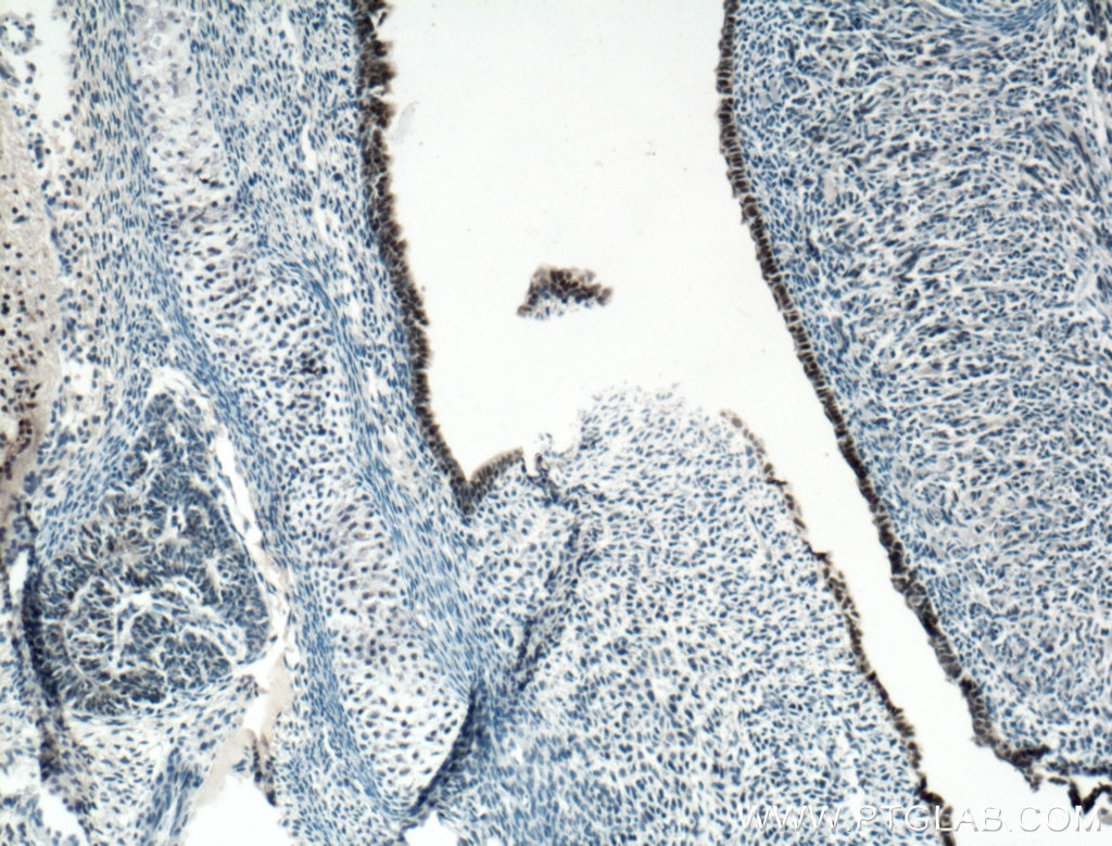 Immunohistochemistry (IHC) staining of mouse embryo tissue using SOX2 Polyclonal antibody (11064-1-AP)