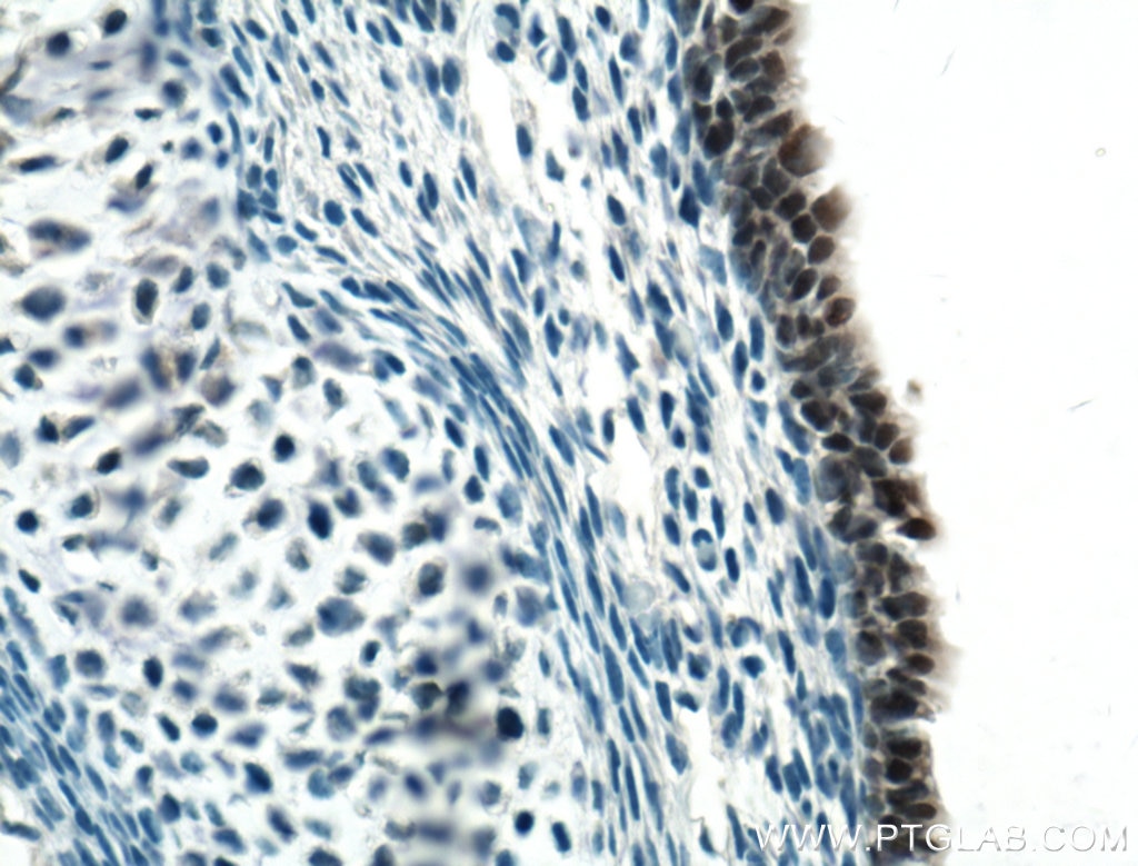 Immunohistochemistry (IHC) staining of mouse embryo tissue using SOX2 Polyclonal antibody (11064-1-AP)