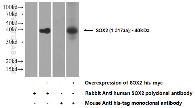 SOX2 Polyclonal antibody