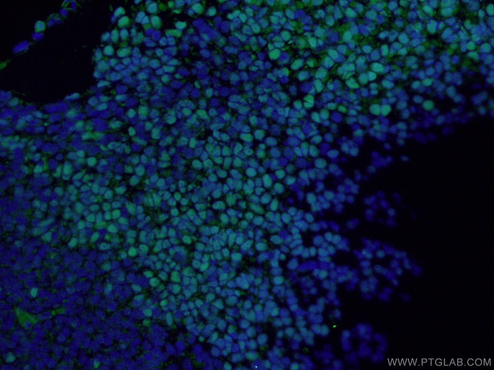 Immunofluorescence (IF) / fluorescent staining of mouse embryo tissue using SOX2 Polyclonal antibody (20118-1-AP)