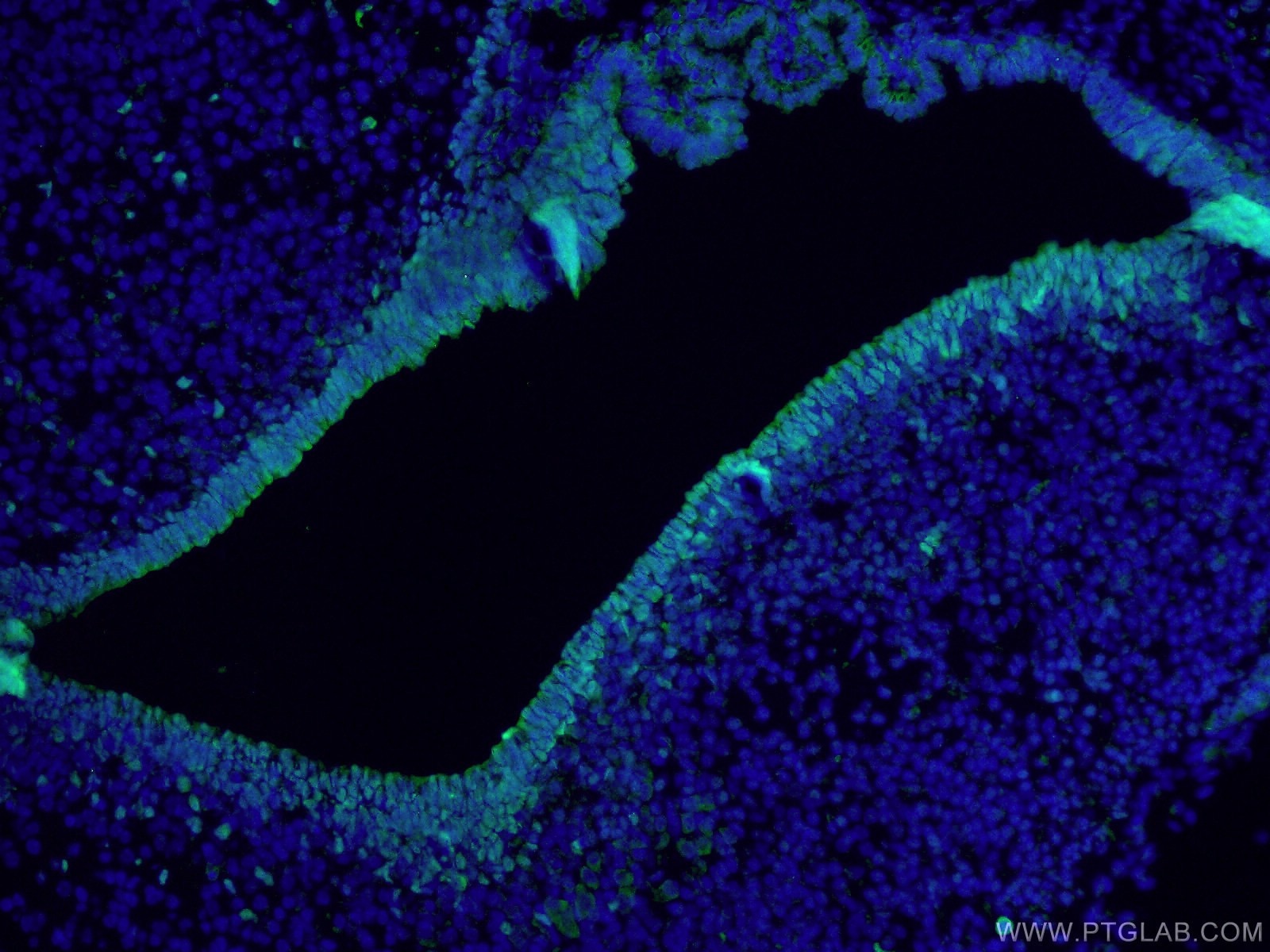 IF Staining of mouse embryo using 20118-1-AP