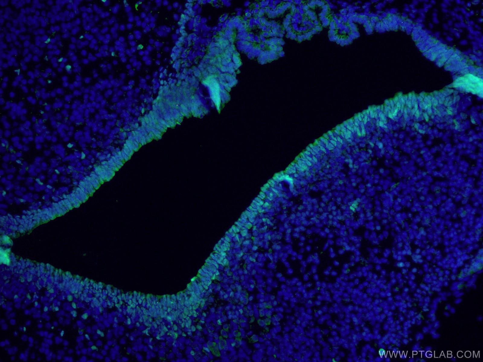 Immunofluorescence (IF) / fluorescent staining of mouse embryo tissue using SOX2 Polyclonal antibody (20118-1-AP)