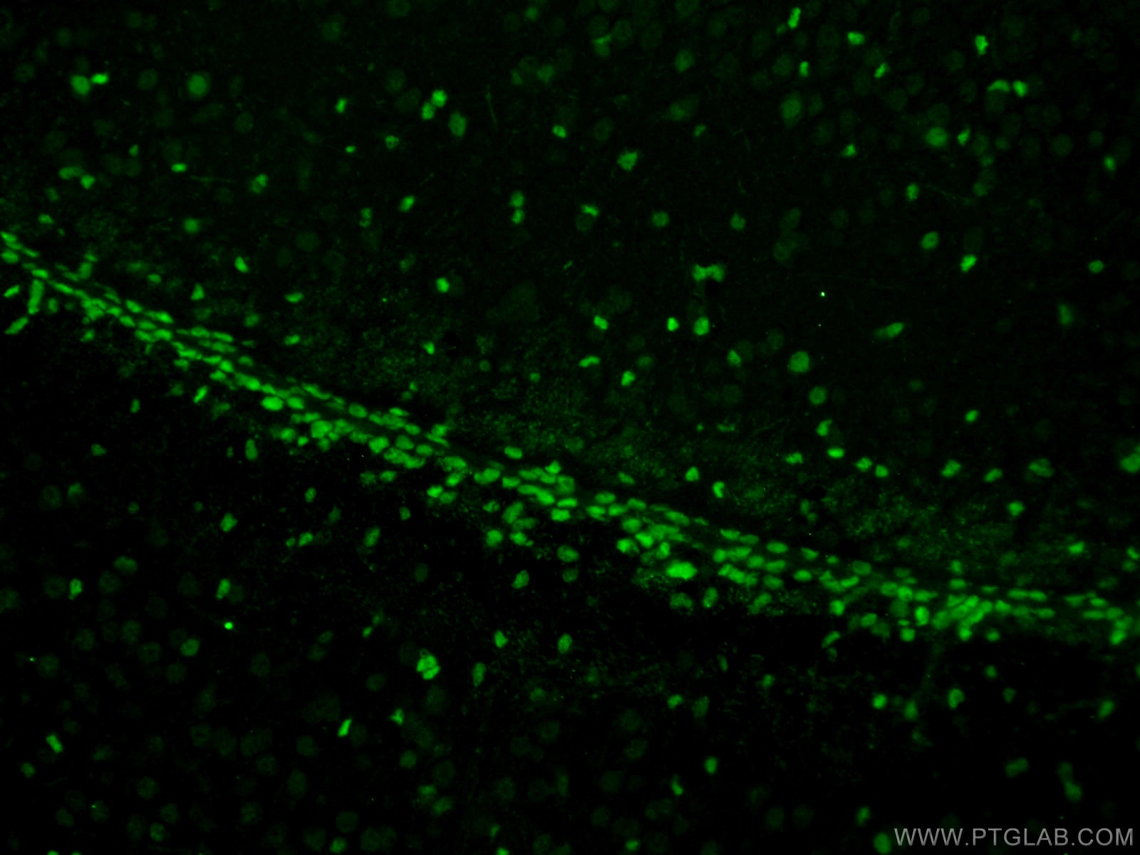 Immunofluorescence (IF) / fluorescent staining of mouse brain tissue using SOX2 Polyclonal antibody (20118-1-AP)