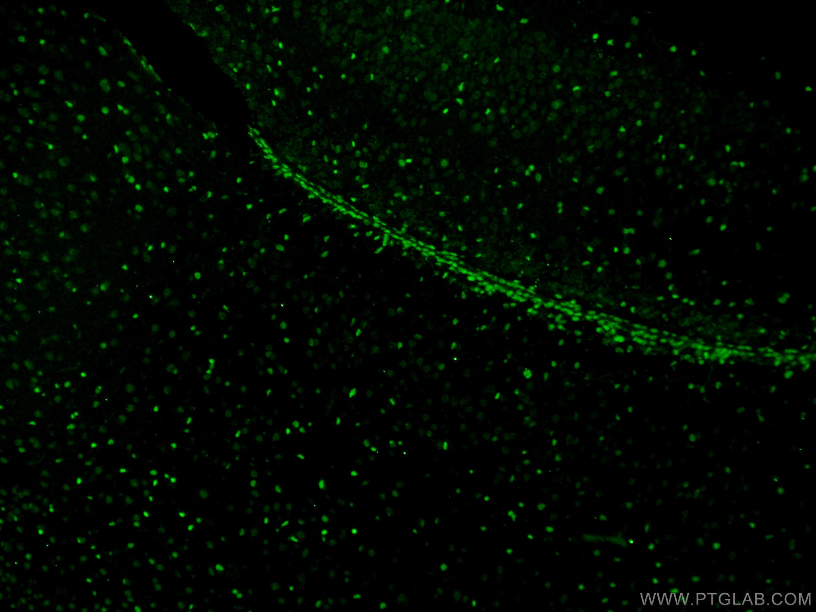 Immunofluorescence (IF) / fluorescent staining of mouse brain tissue using SOX2 Polyclonal antibody (20118-1-AP)