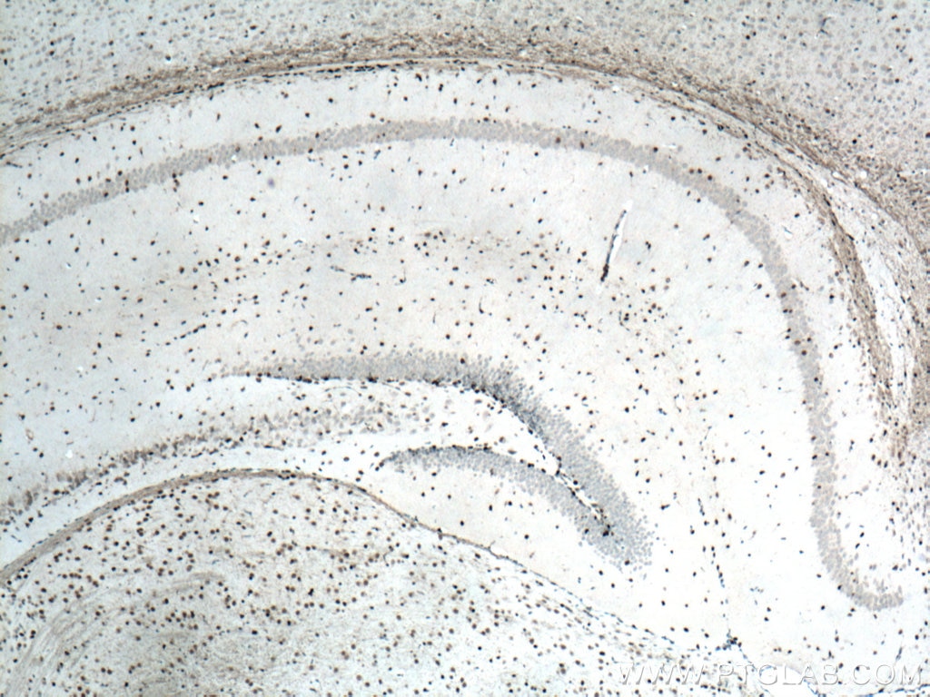Immunohistochemistry (IHC) staining of mouse brain tissue using SOX2 Polyclonal antibody (20118-1-AP)