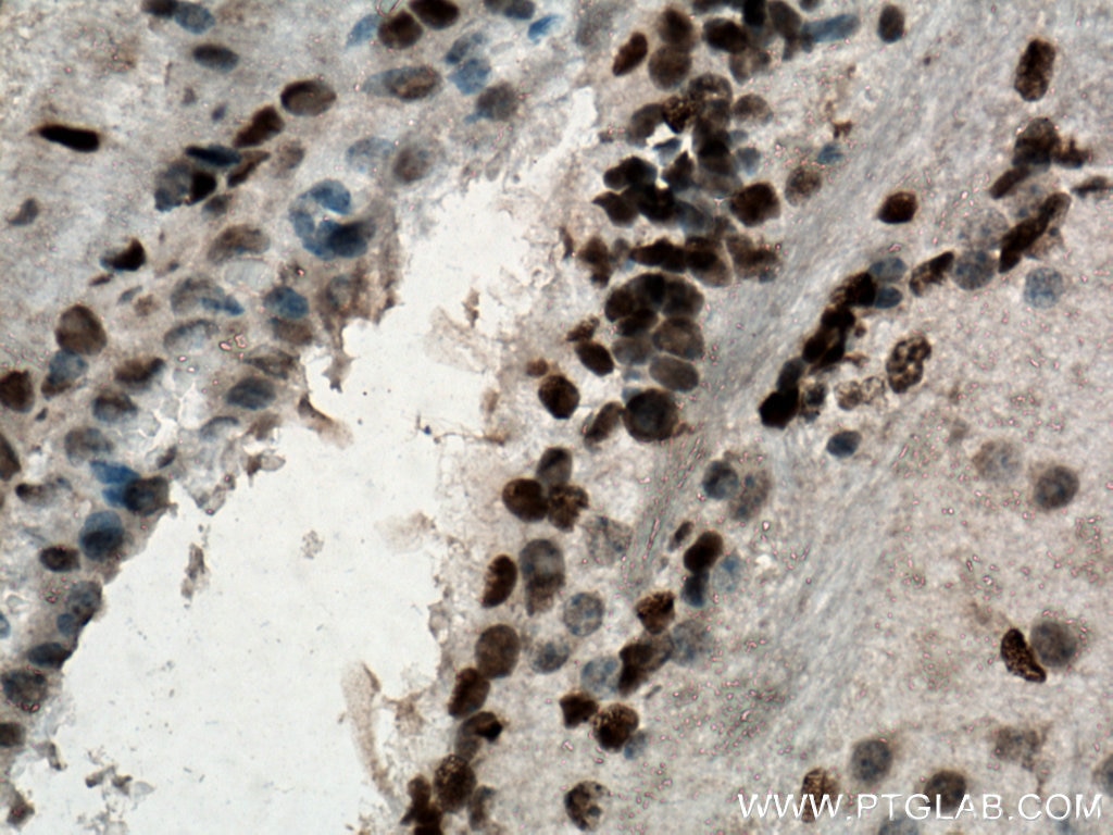 Immunohistochemistry (IHC) staining of mouse brain tissue using SOX2 Polyclonal antibody (20118-1-AP)