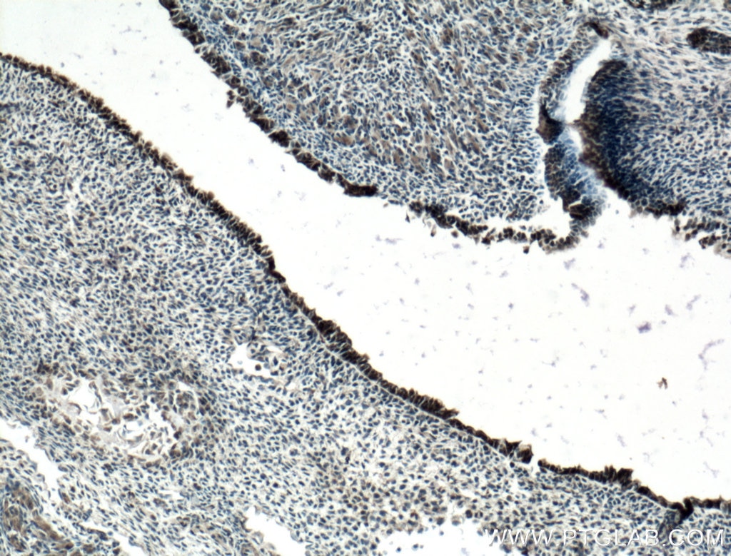 Immunohistochemistry (IHC) staining of mouse embryo tissue using SOX2 Polyclonal antibody (20118-1-AP)