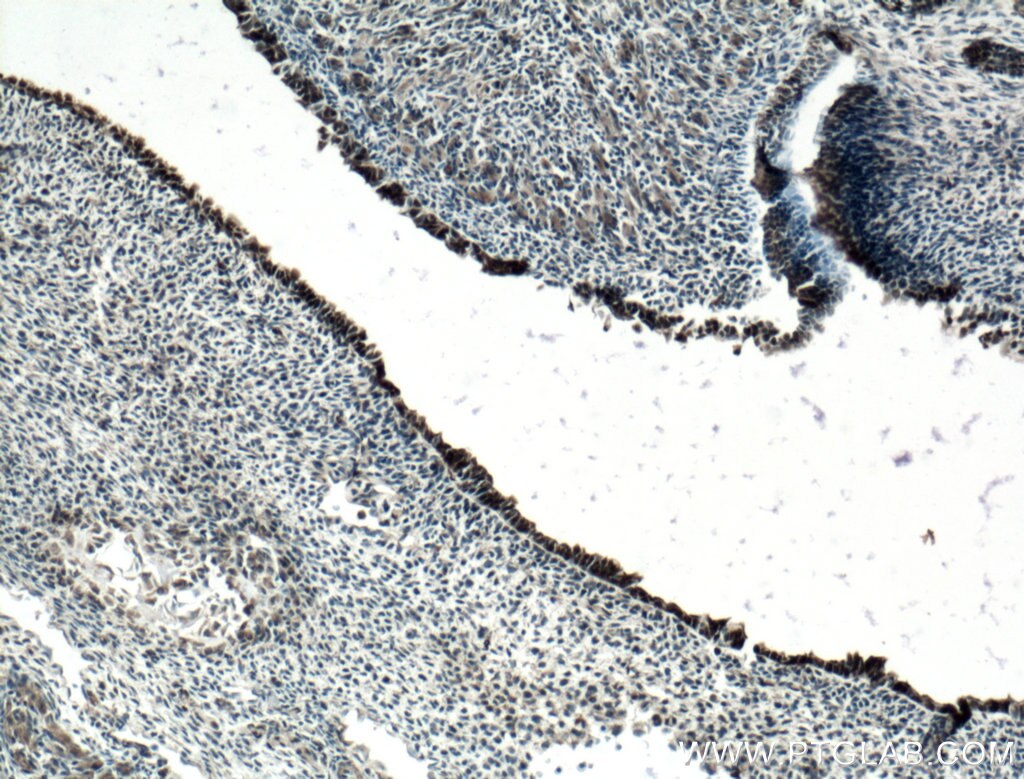 IHC staining of mouse embryo using 20118-1-AP