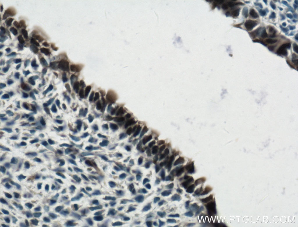 Immunohistochemistry (IHC) staining of mouse embryo tissue using SOX2 Polyclonal antibody (20118-1-AP)