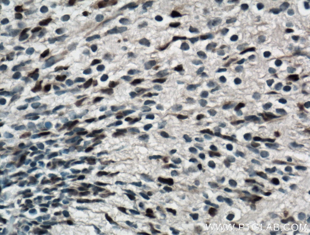 Immunohistochemistry (IHC) staining of mouse embryo tissue using SOX2 Polyclonal antibody (20118-1-AP)