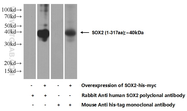 Western Blot (WB) analysis of Transfected HEK-293 cells using SOX2 Polyclonal antibody (20118-1-AP)