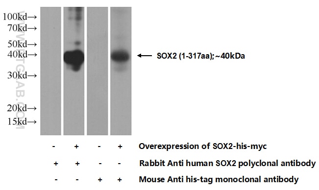 WB analysis of Transfected HEK-293 using 20118-1-AP