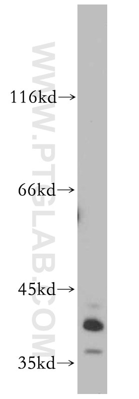 Western Blot (WB) analysis of mouse brain tissue using SOX2 Polyclonal antibody (20118-1-AP)