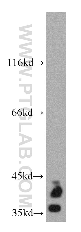 Western Blot (WB) analysis of mouse brain tissue using SOX2 Polyclonal antibody (20118-1-AP)