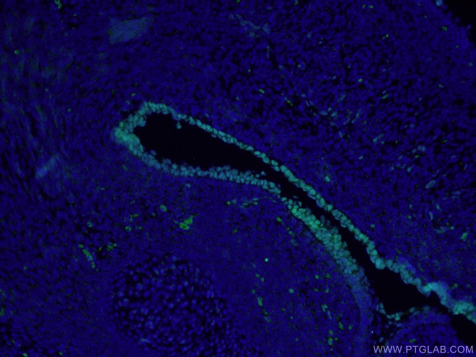 Immunofluorescence (IF) / fluorescent staining of mouse embryo tissue using SOX2 Monoclonal antibody (66411-1-Ig)
