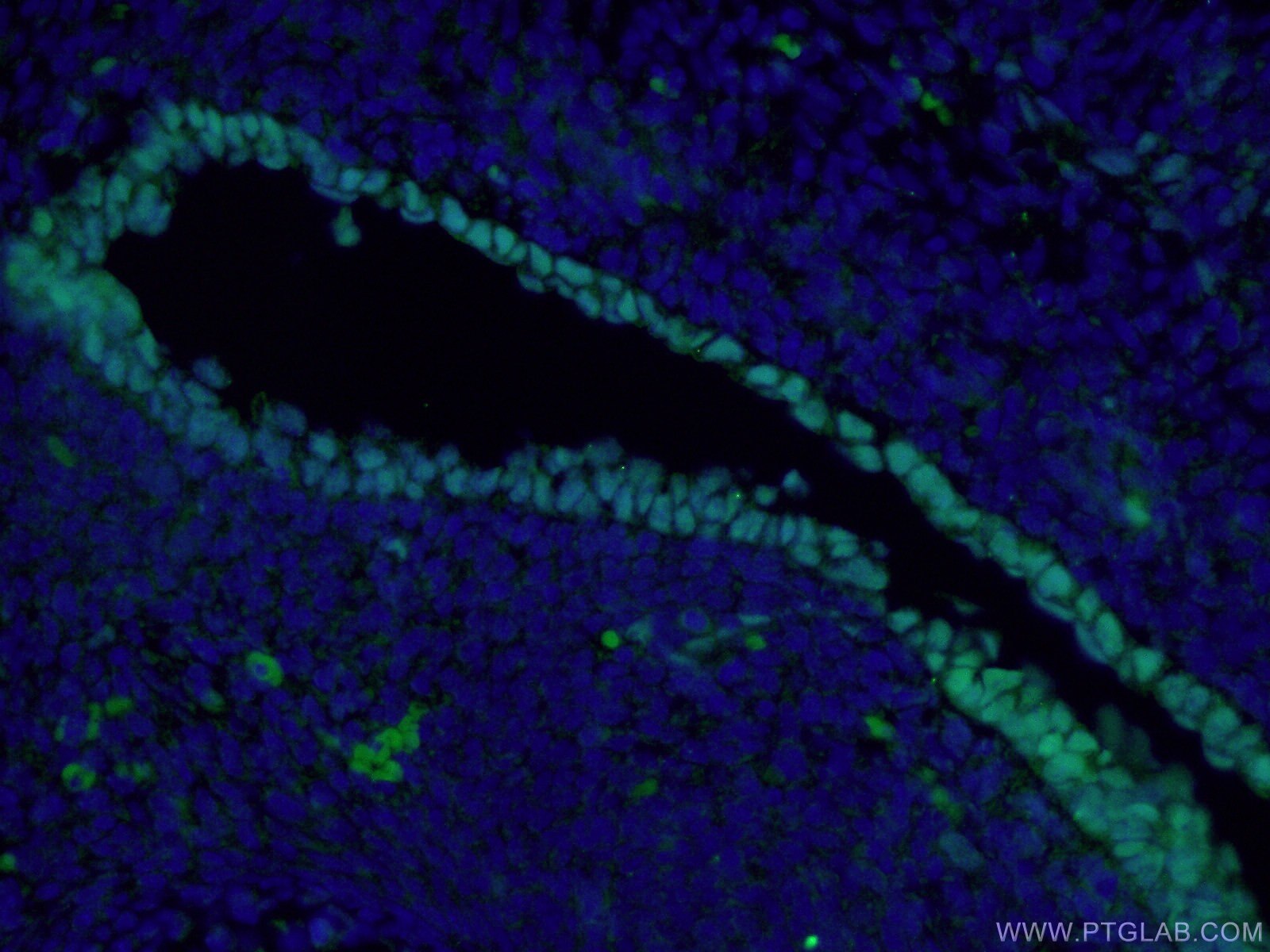 Immunofluorescence (IF) / fluorescent staining of mouse embryo tissue using SOX2 Monoclonal antibody (66411-1-Ig)