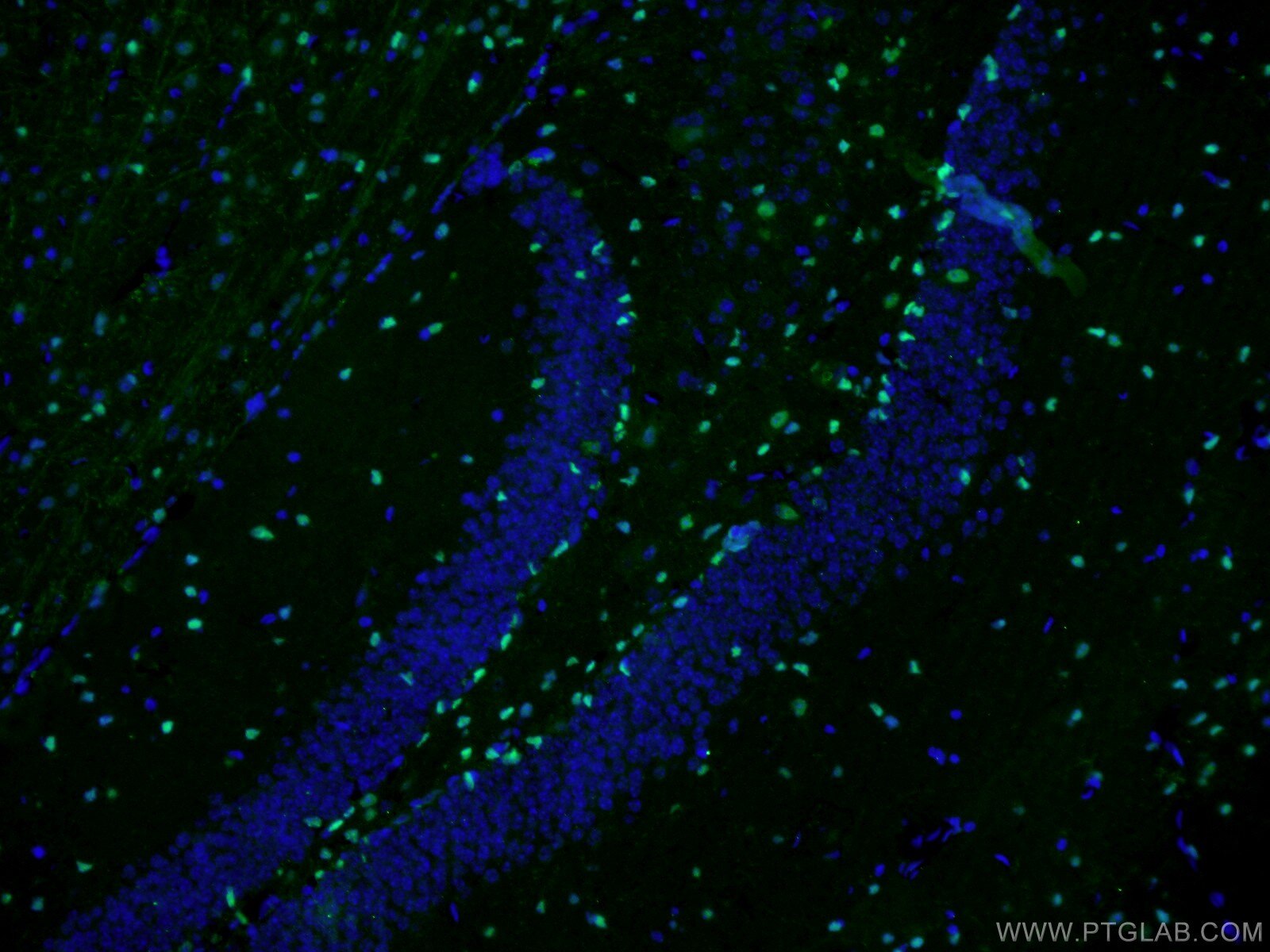 Immunofluorescence (IF) / fluorescent staining of mouse brain tissue using SOX2 Monoclonal antibody (66411-1-Ig)