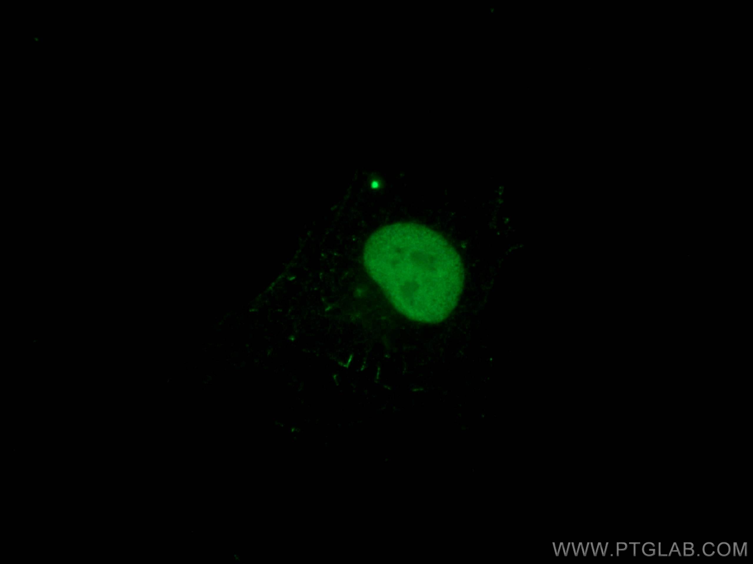 Immunofluorescence (IF) / fluorescent staining of U-251 cells using SOX2 Monoclonal antibody (66411-1-Ig)