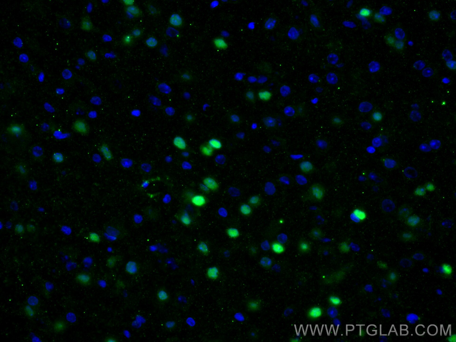Immunofluorescence (IF) / fluorescent staining of rat brain tissue using SOX2 Monoclonal antibody (66411-1-Ig)