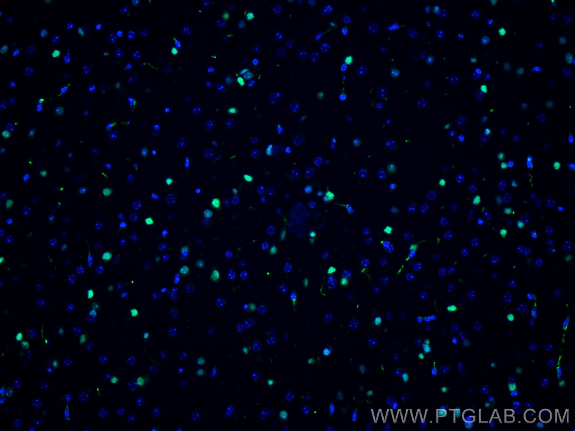 Immunofluorescence (IF) / fluorescent staining of mouse brain tissue using SOX2 Monoclonal antibody (66411-1-Ig)
