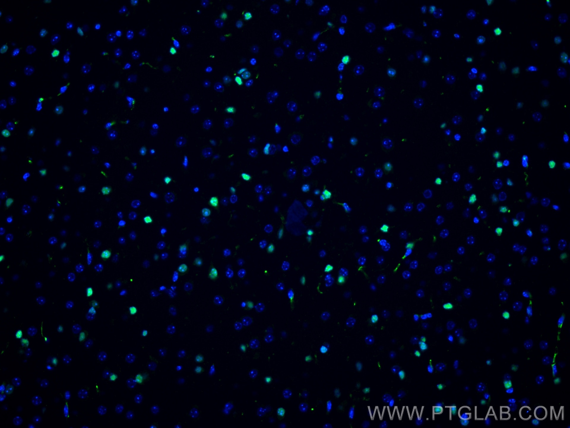 IF Staining of mouse brain using 66411-1-Ig