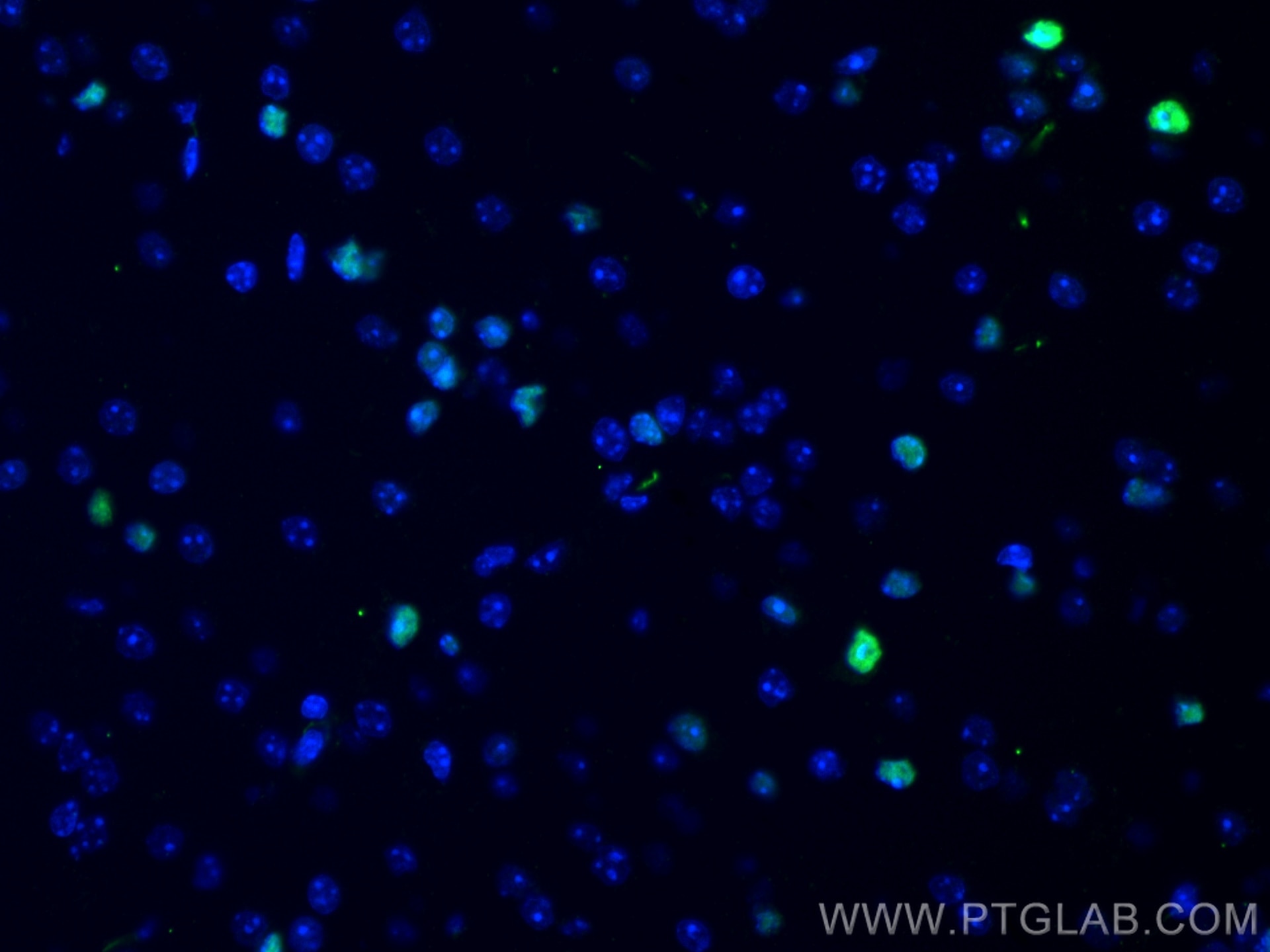 Immunofluorescence (IF) / fluorescent staining of mouse brain tissue using SOX2 Monoclonal antibody (66411-1-Ig)