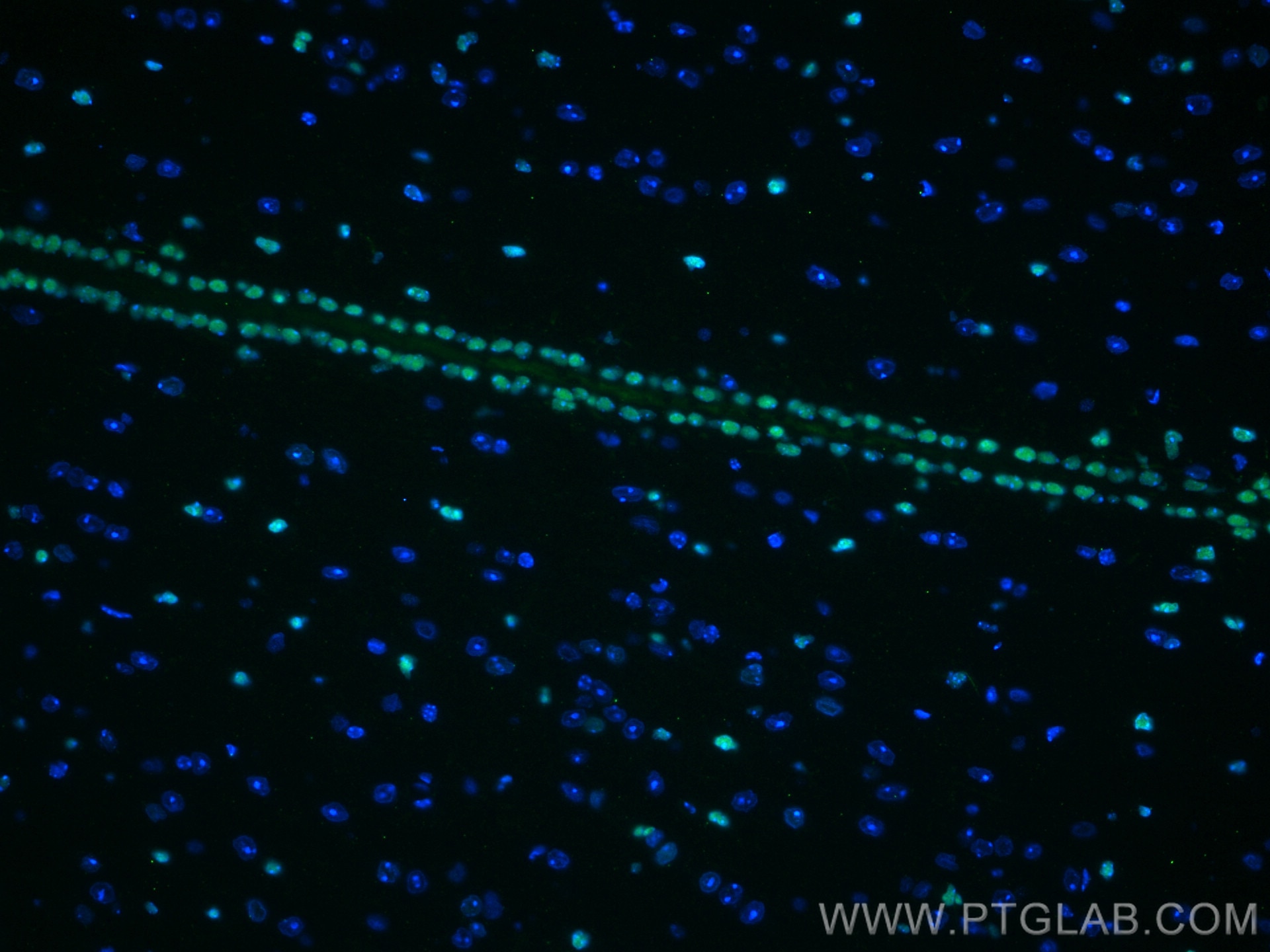 Immunofluorescence (IF) / fluorescent staining of mouse brain tissue using SOX2 Monoclonal antibody (66411-1-Ig)