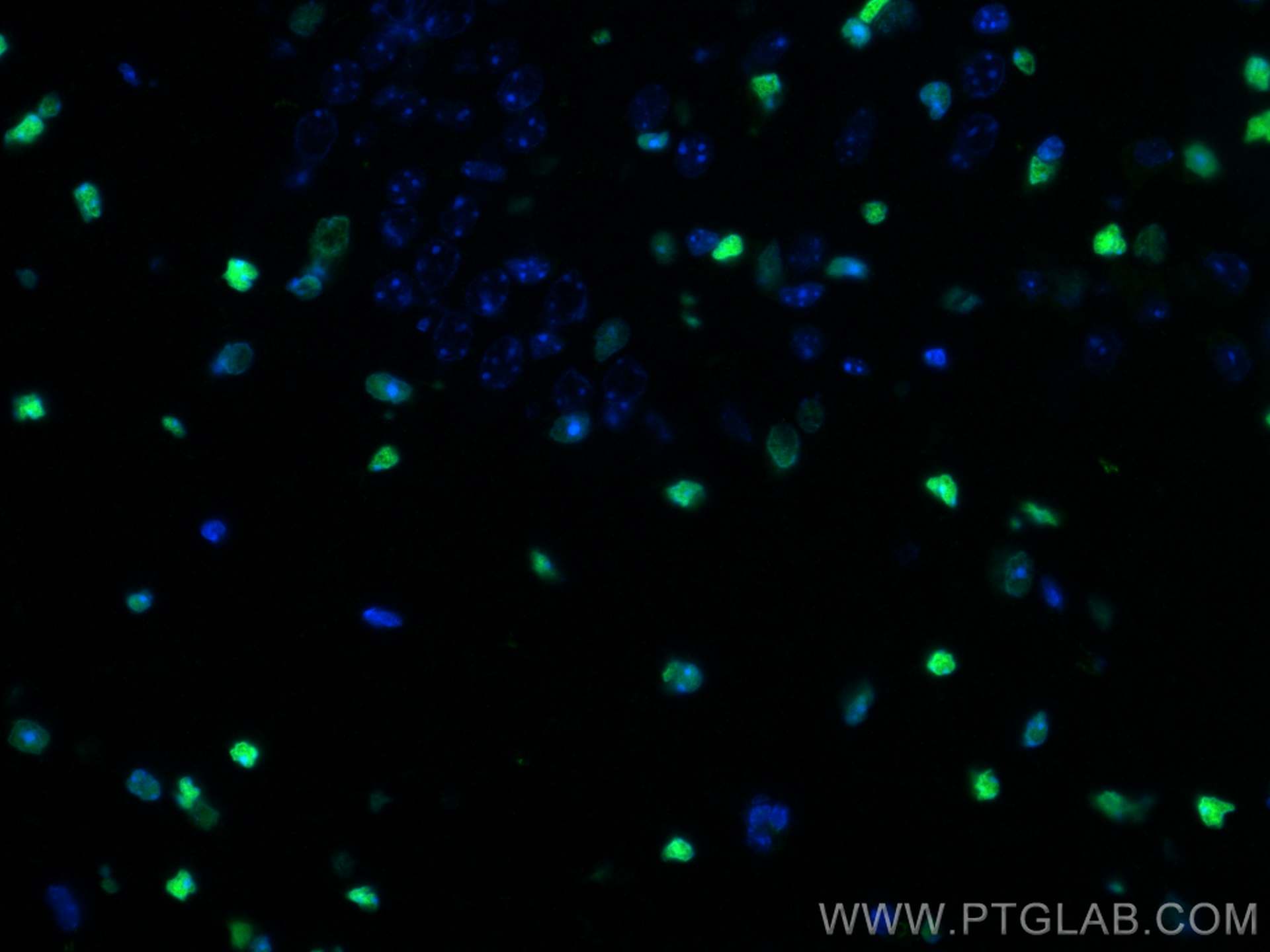 Immunofluorescence (IF) / fluorescent staining of mouse brain tissue using SOX2 Monoclonal antibody (66411-1-Ig)