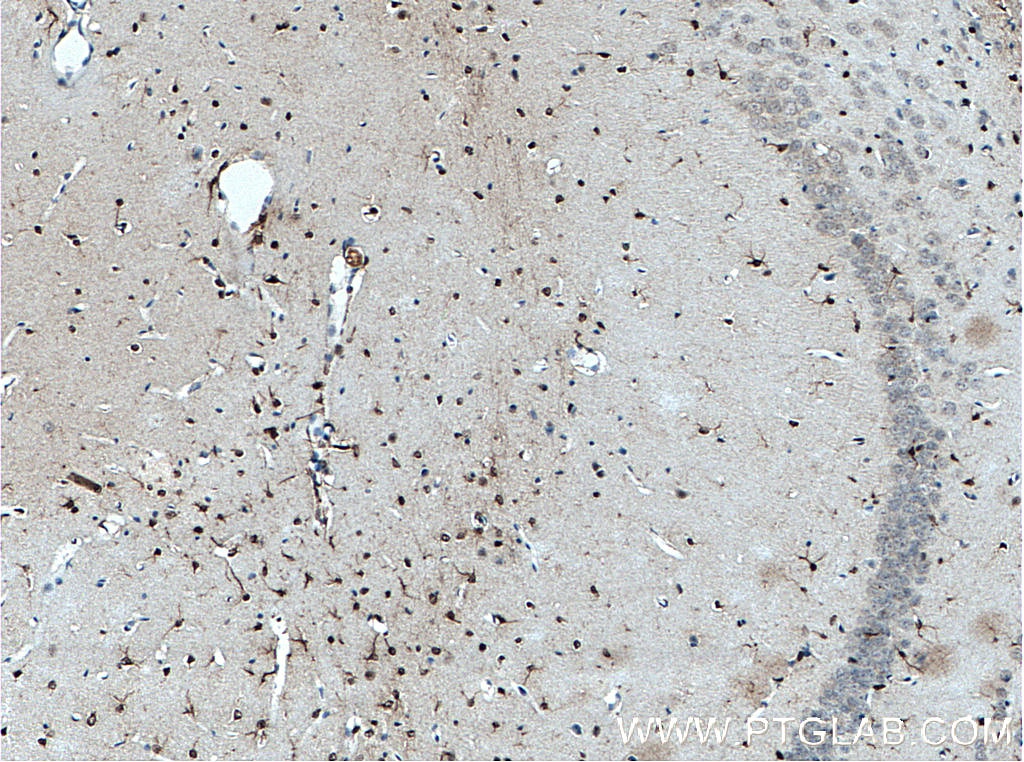 Immunohistochemistry (IHC) staining of mouse brain tissue using SOX2 Monoclonal antibody (66411-1-Ig)
