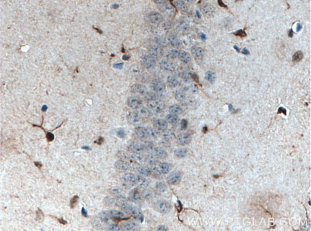 Immunohistochemistry (IHC) staining of mouse brain tissue using SOX2 Monoclonal antibody (66411-1-Ig)