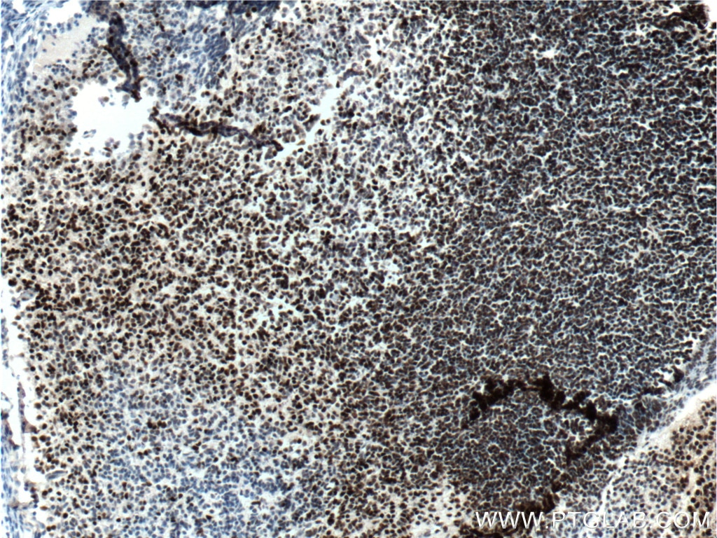 Immunohistochemistry (IHC) staining of mouse embryo tissue using SOX2 Monoclonal antibody (66411-1-Ig)