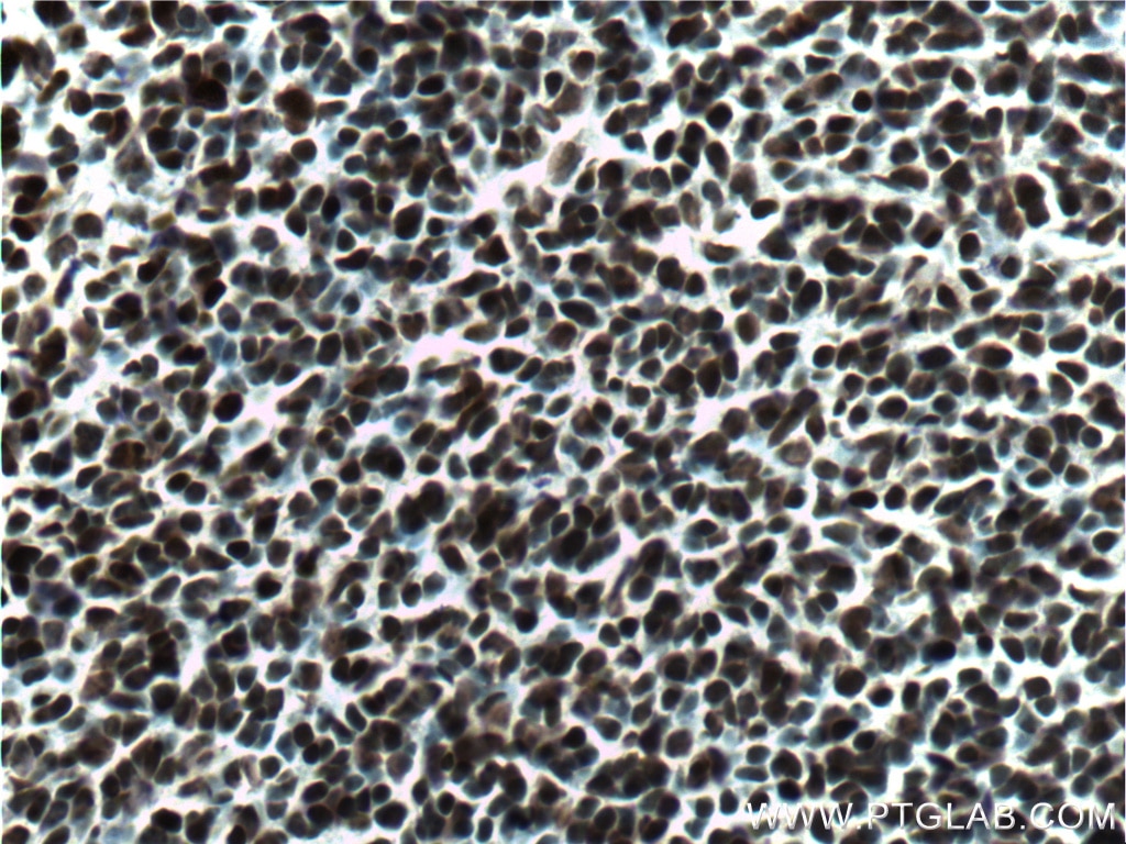 Immunohistochemistry (IHC) staining of mouse embryo tissue using SOX2 Monoclonal antibody (66411-1-Ig)