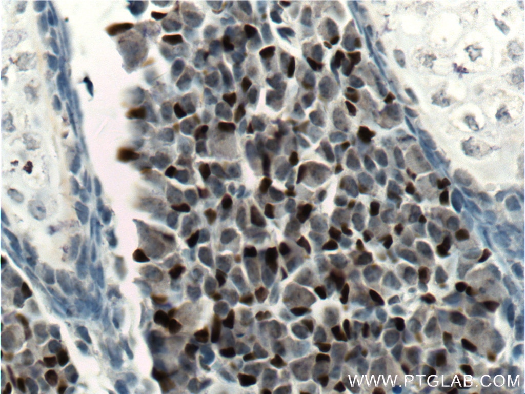 Immunohistochemistry (IHC) staining of mouse embryo tissue using SOX2 Monoclonal antibody (66411-1-Ig)