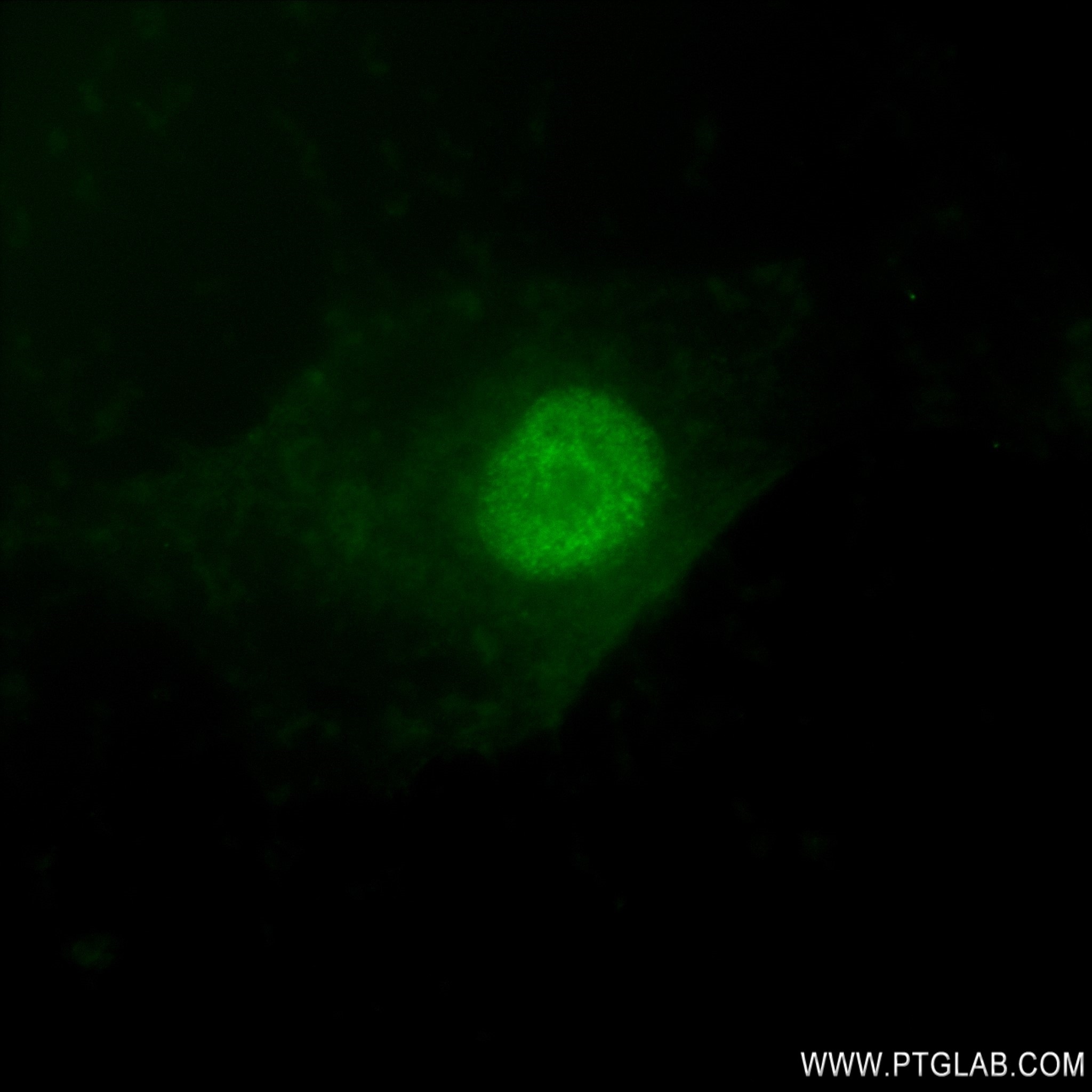 Immunofluorescence (IF) / fluorescent staining of U-251 cells using SOX2 Recombinant antibody (83059-5-RR)