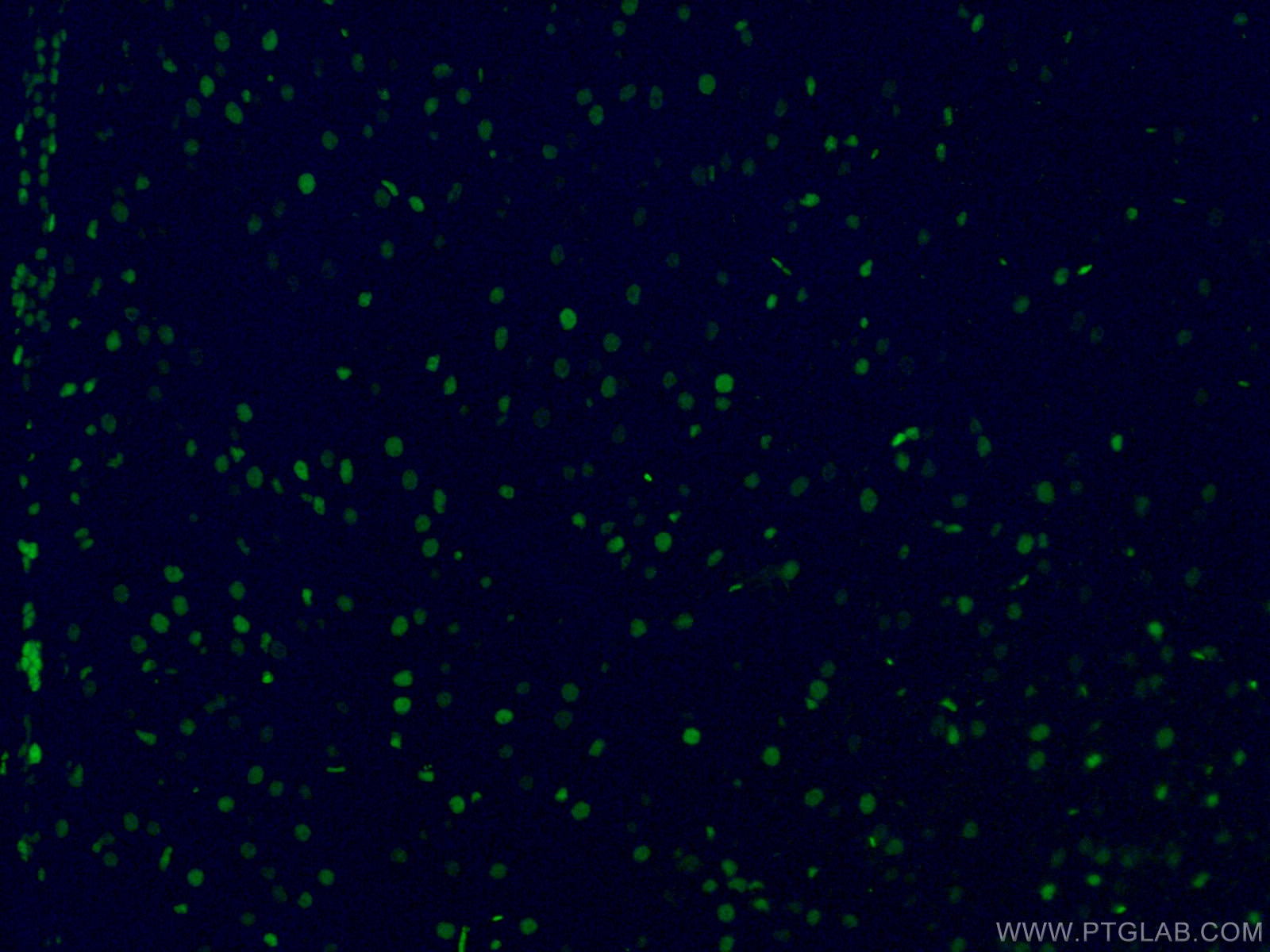 IF Staining of mouse brain using CL488-66411