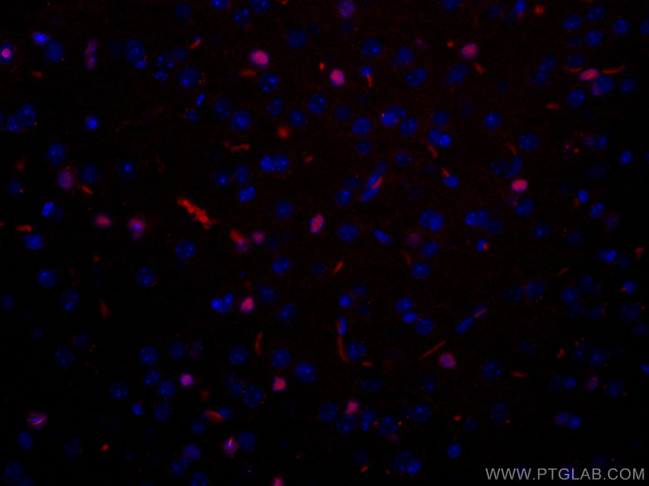 Immunofluorescence (IF) / fluorescent staining of mouse brain tissue using CoraLite®594-conjugated SOX2 Polyclonal antibody (CL594-11064)