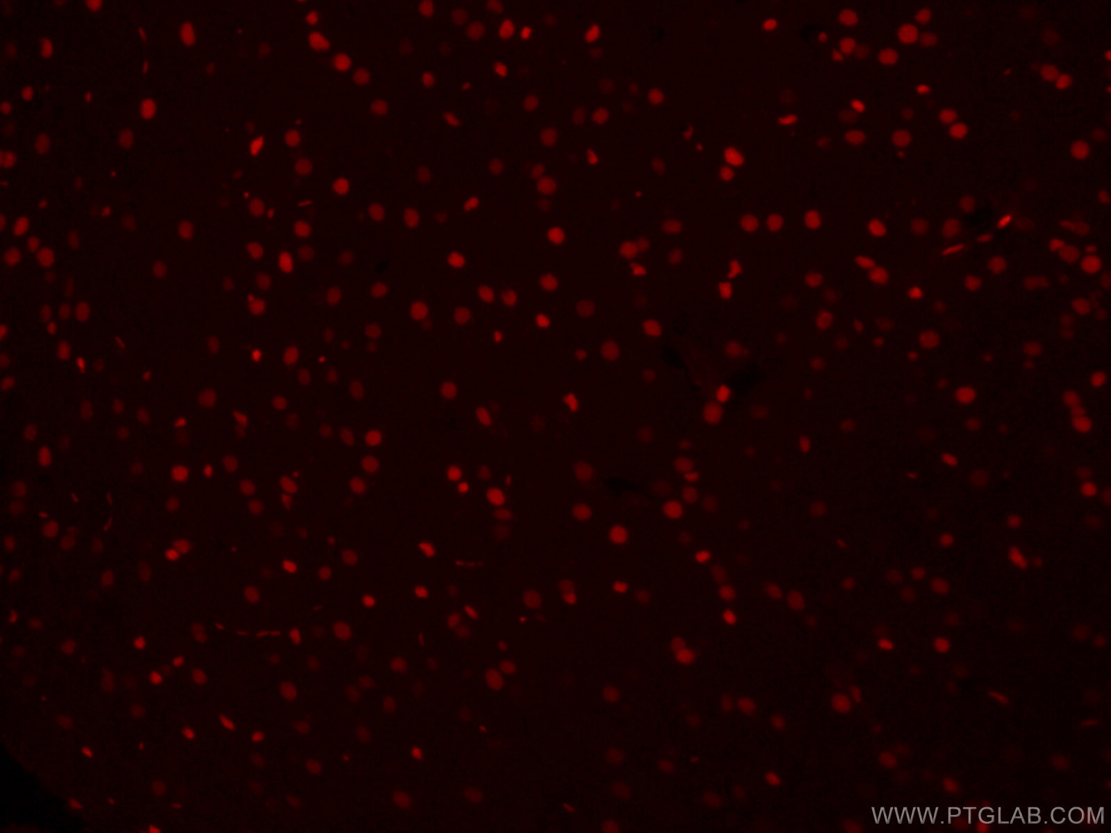 Immunofluorescence (IF) / fluorescent staining of mouse brain tissue using CoraLite®594-conjugated SOX2 Monoclonal antibody (CL594-66411)