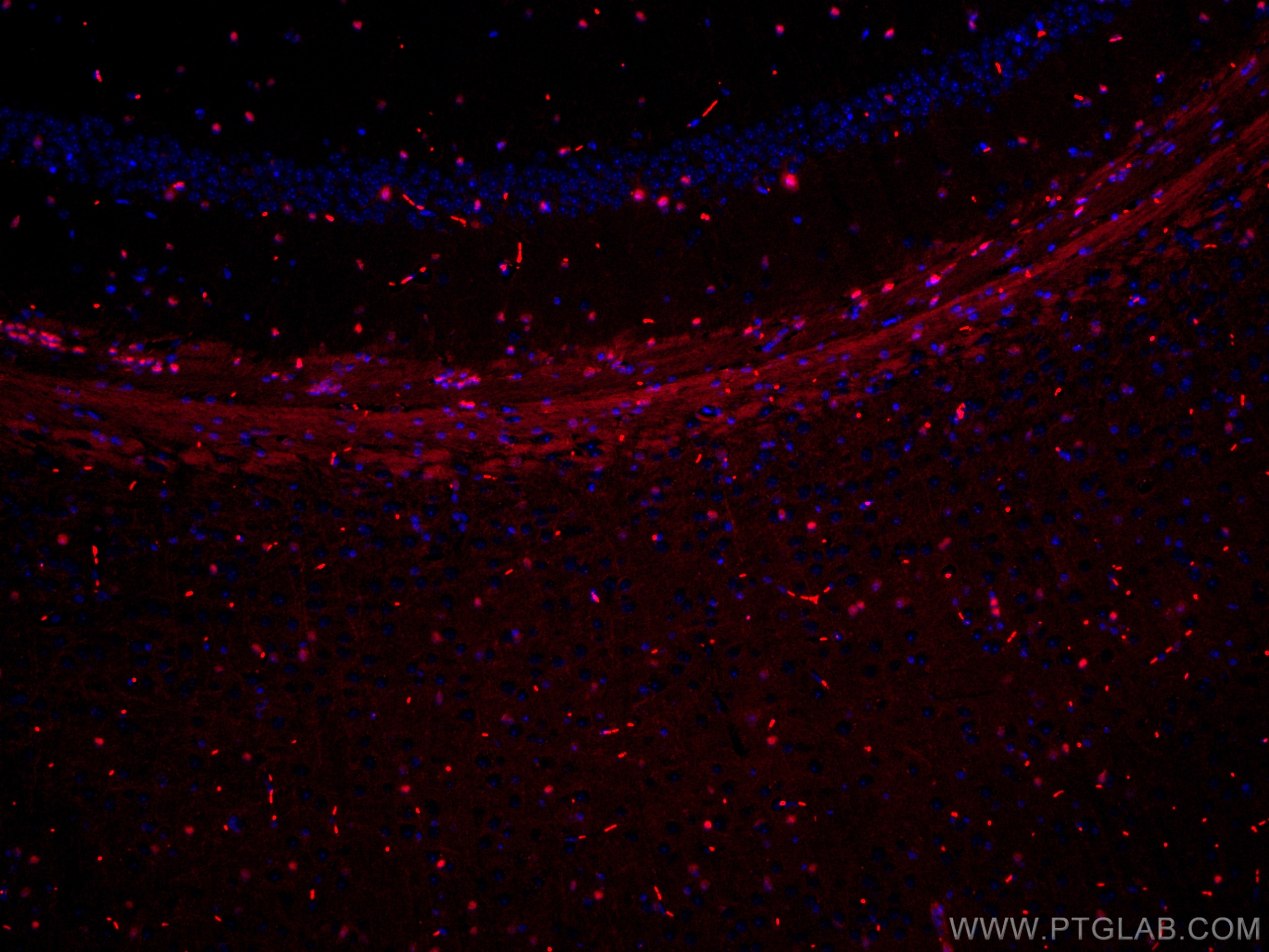 IF Staining of mouse brain using CL594-66411