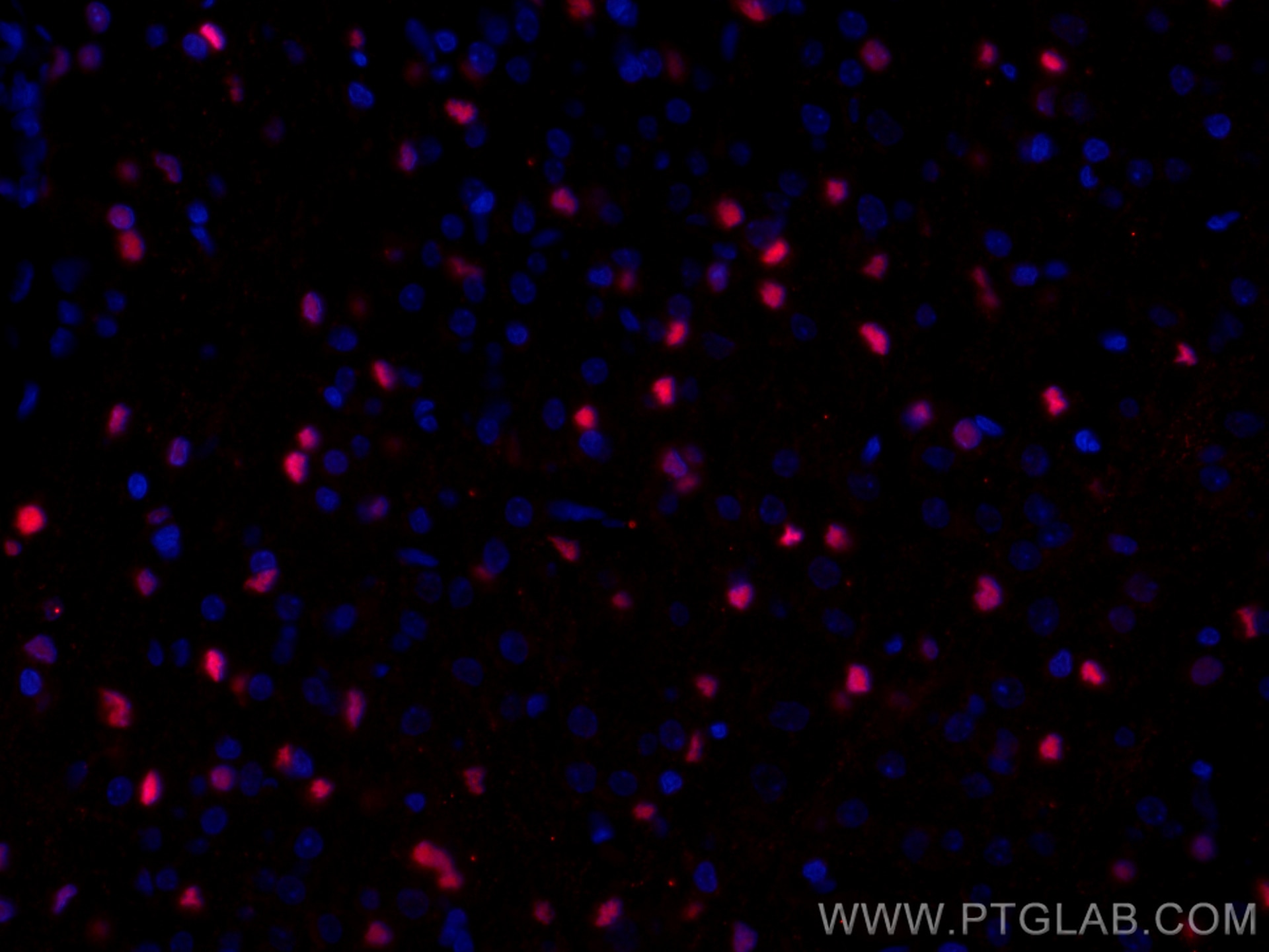 Immunofluorescence (IF) / fluorescent staining of rat brain tissue using CoraLite®594-conjugated SOX2 Monoclonal antibody (CL594-66411)