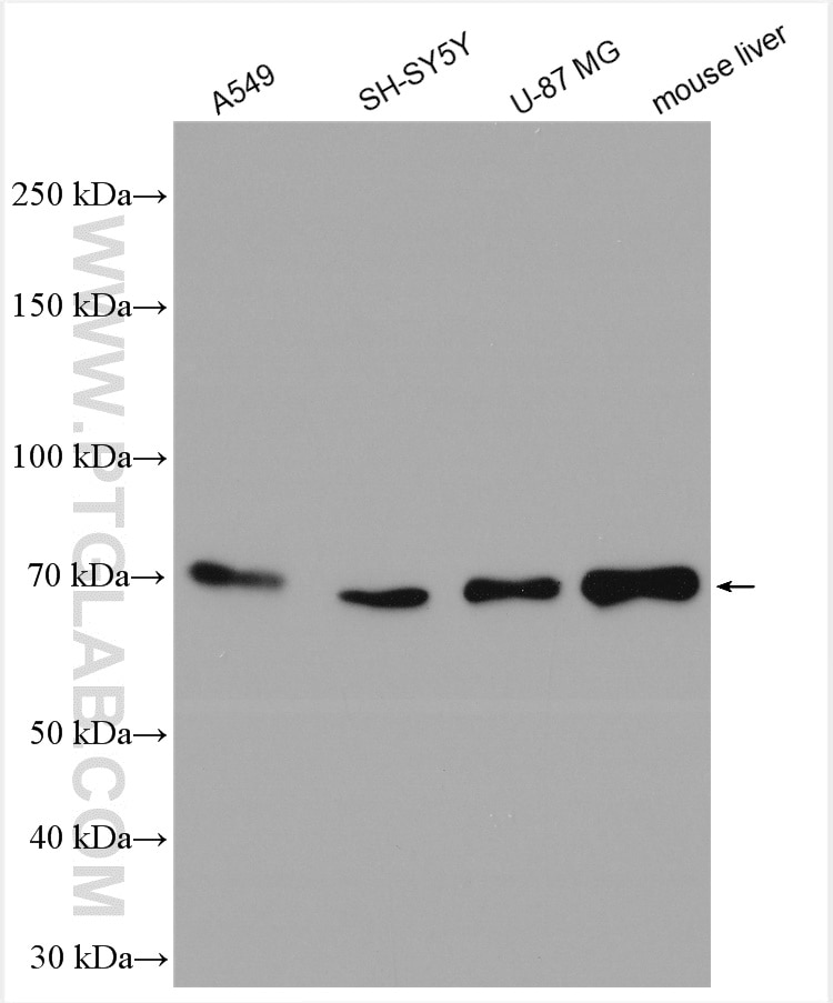 Western Blot (WB) analysis of various lysates using SOX5 Polyclonal antibody (13216-1-AP)