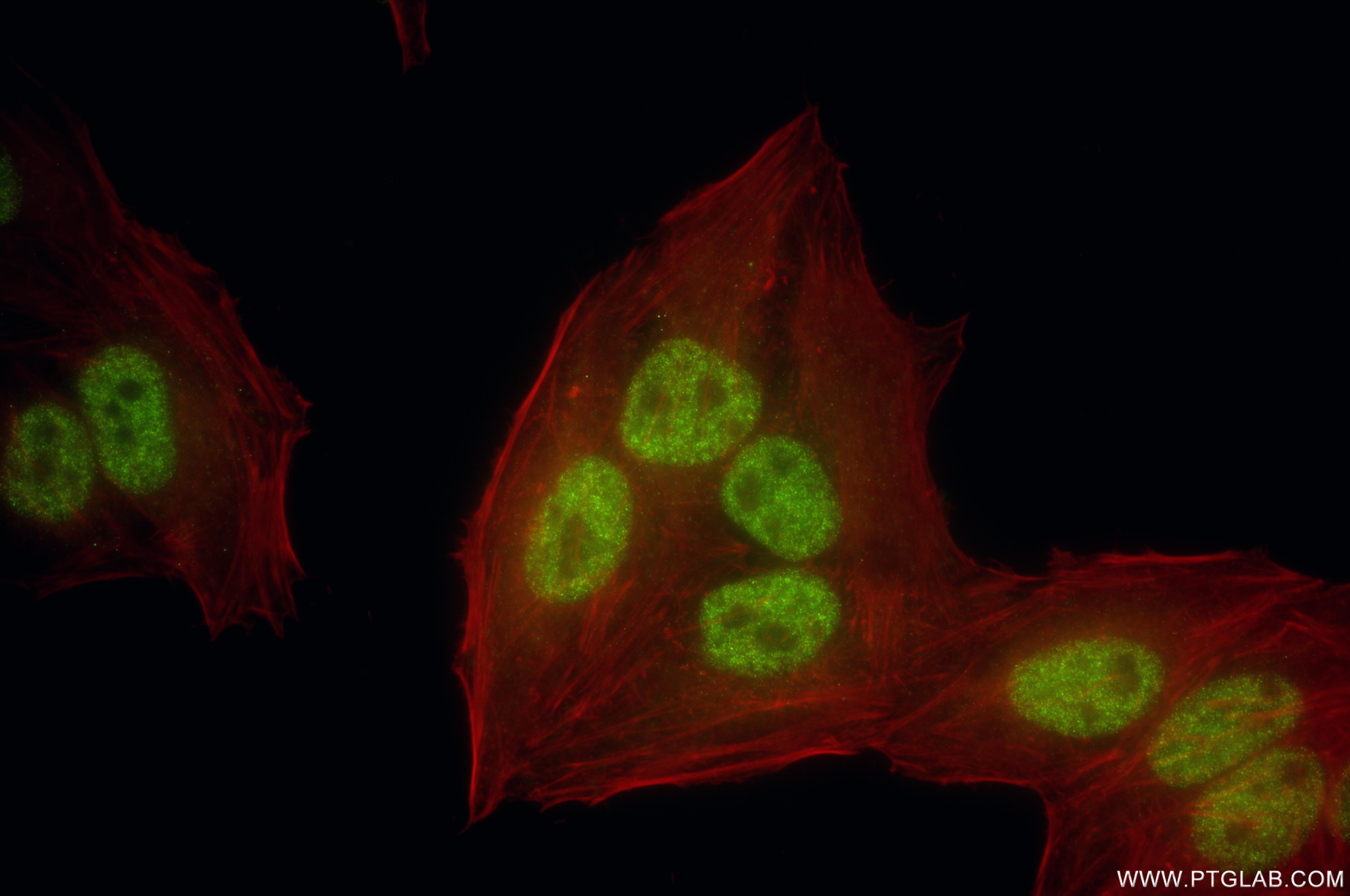 IF Staining of HepG2 using 86619-2-RR (same clone as 86619-2-PBS) Immunofluorescence (IF) / fluorescent staining of HepG2 cells using SOX5 Recombinant monoclonal antibody (86619-2-RR)