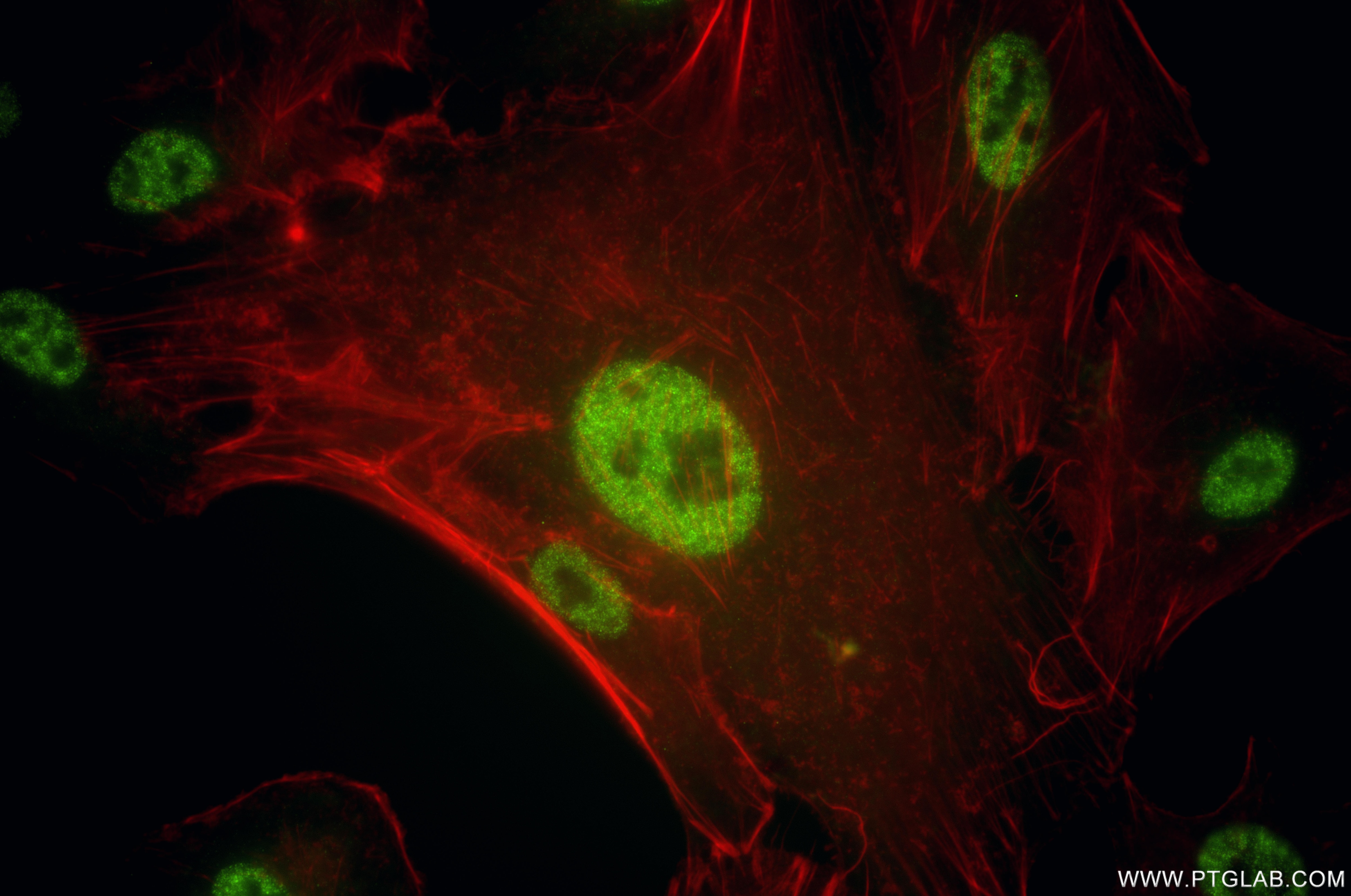 IF Staining of A549 using 86619-2-RR (same clone as 86619-2-PBS) Immunofluorescence (IF) / fluorescent staining of A549 cells using SOX5 Recombinant monoclonal antibody (86619-2-RR)
