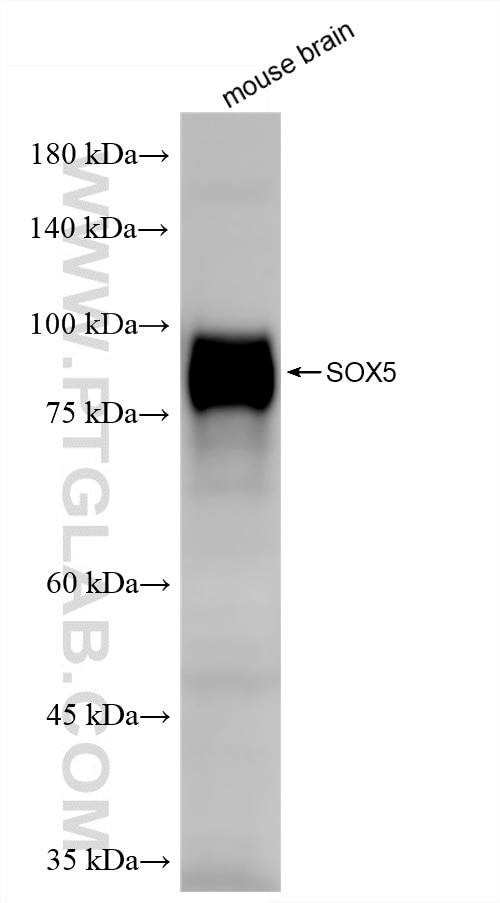 WB analysis of mouse brain using 86619-2-RR (same clone as 86619-2-PBS) Western Blot (WB) analysis of mouse brain tissue using SOX5 Recombinant monoclonal antibody (86619-2-RR)