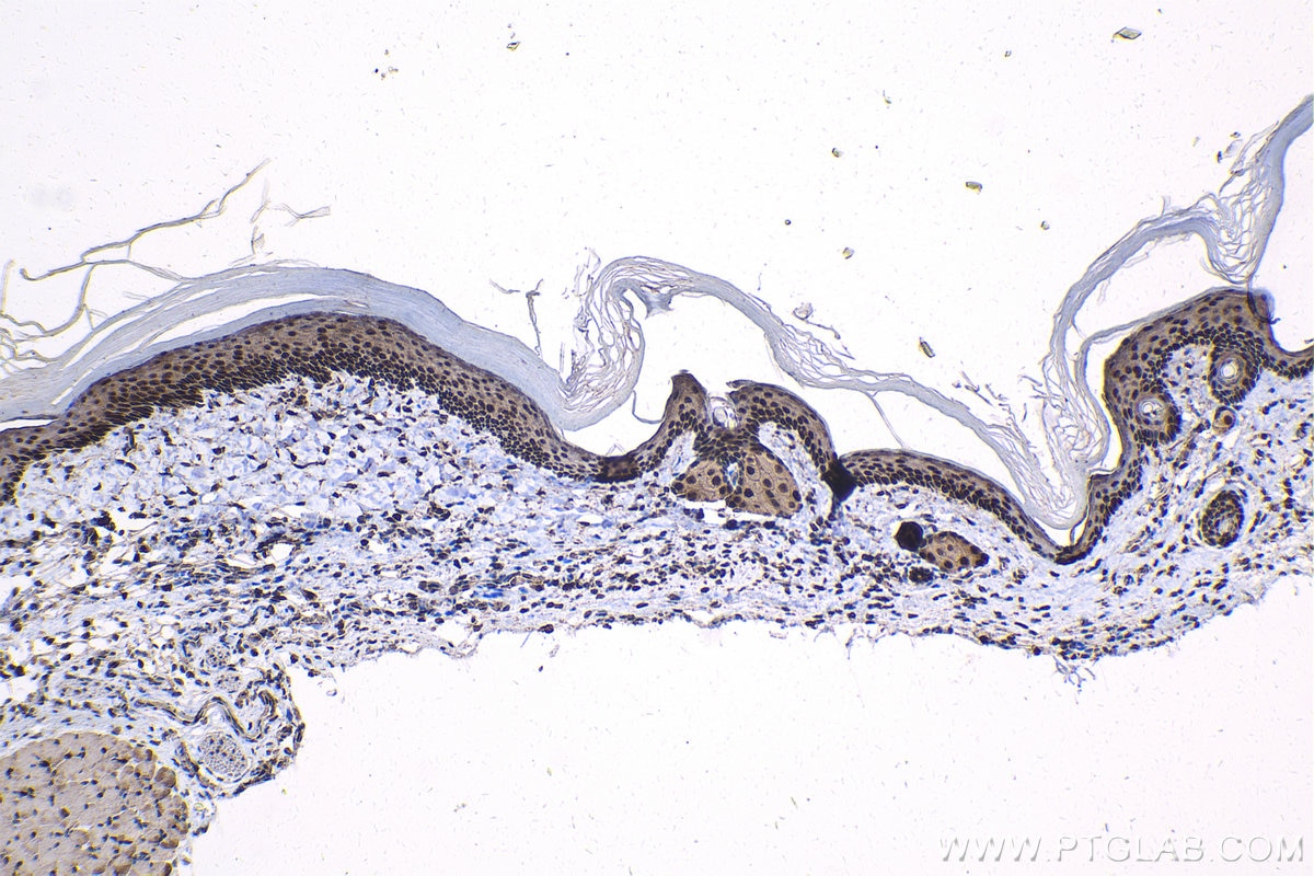 IHC staining of mouse skin using 14010-1-AP