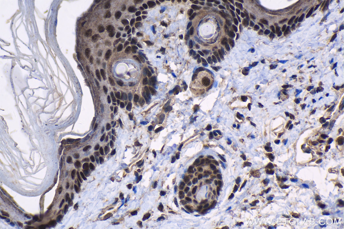 Immunohistochemistry (IHC) staining of mouse skin tissue using SOX6 Polyclonal antibody (14010-1-AP)