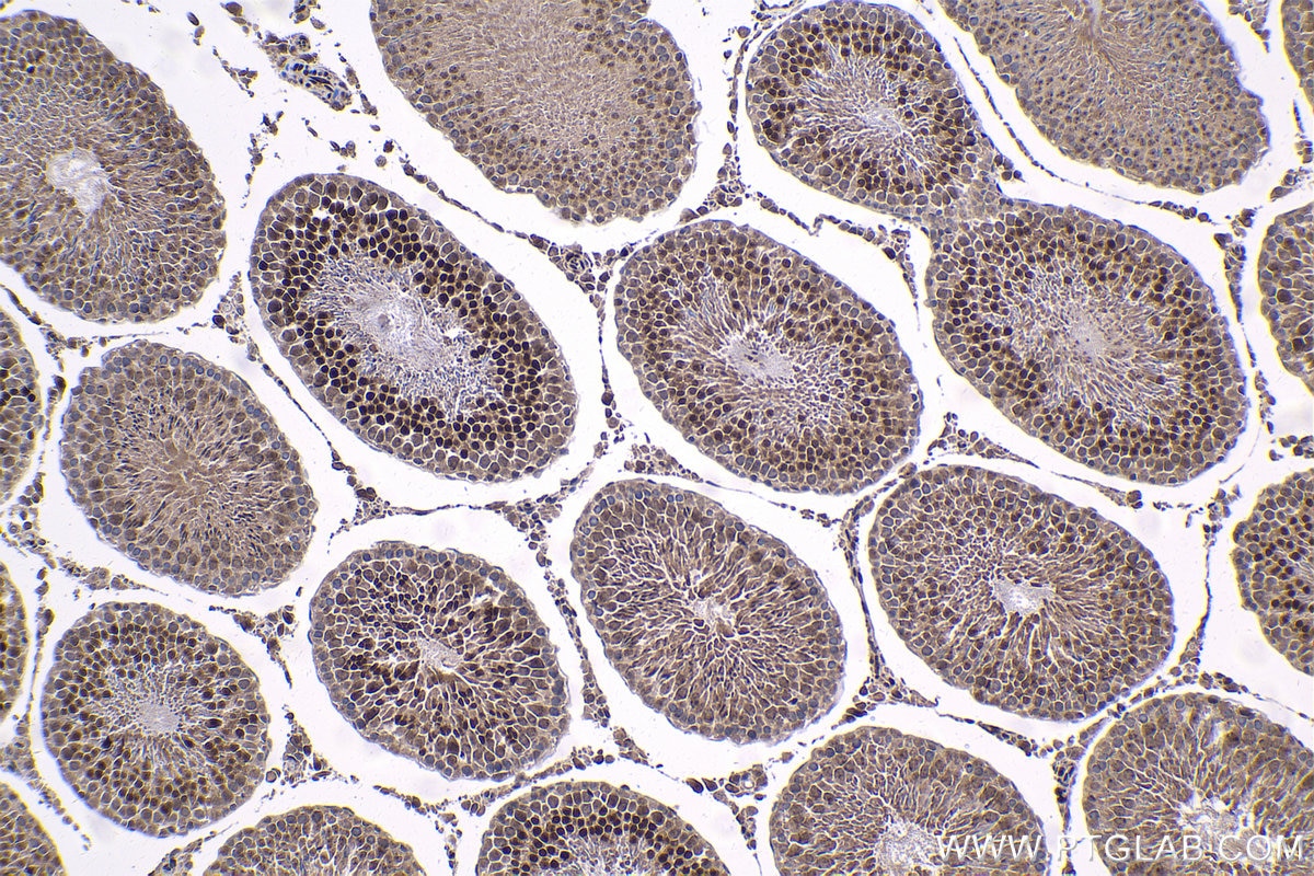 Immunohistochemistry (IHC) staining of rat testis tissue using SOX6 Polyclonal antibody (14010-1-AP)