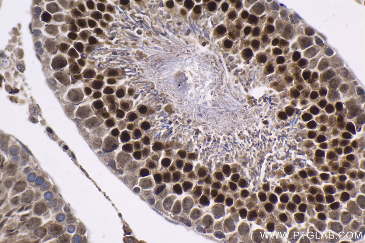 Immunohistochemistry (IHC) staining of rat testis tissue using SOX6 Polyclonal antibody (14010-1-AP)